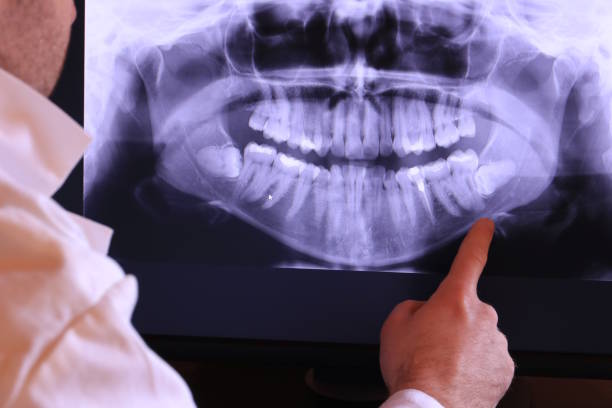 Best Cracked Tooth Emergency Dentist  in Huntgburg, IN